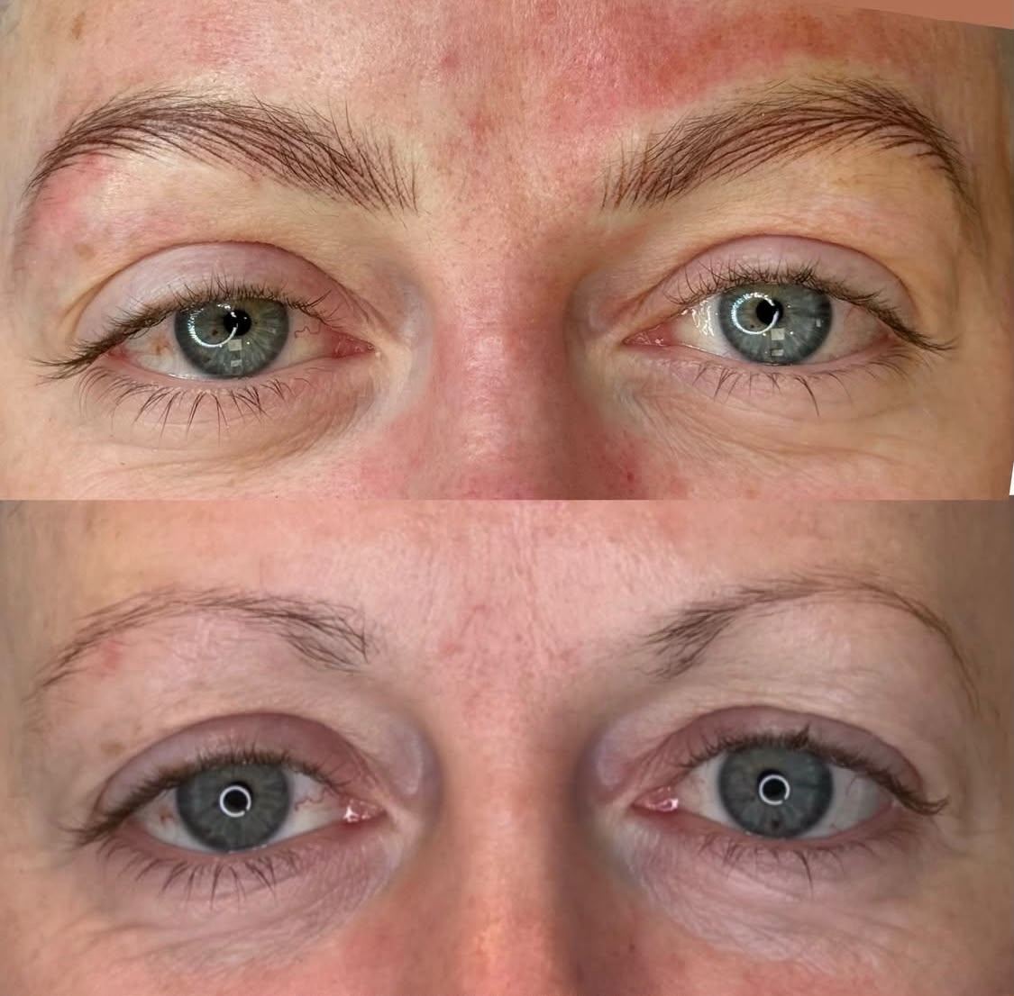 A client's new hair-stroke brows (top) compared with their very sparse brows before (bottom)