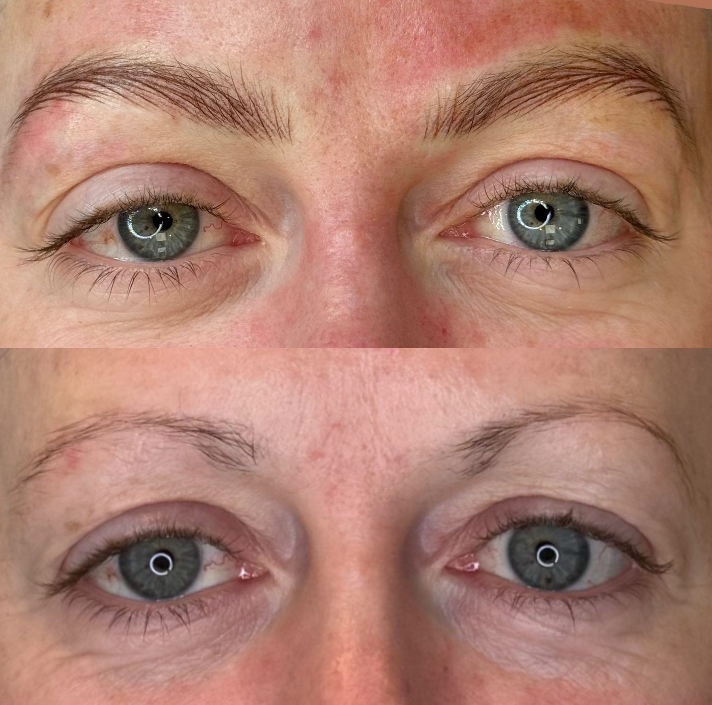 A client's new hair-stroke brows (top) compared with their original faint brows (bottom)