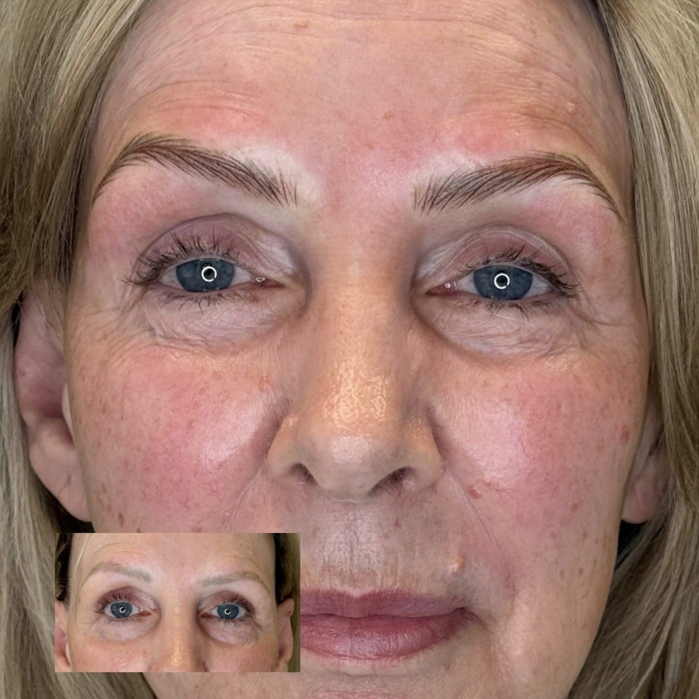 A client with softly defined hair-stroke brows, with an inset showing their faint brows before